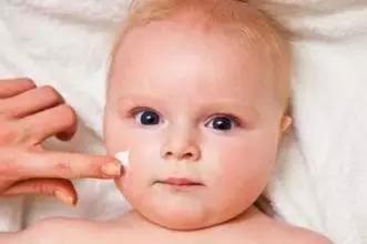 看妈咪娃娃育儿专家解读宝宝湿疹！